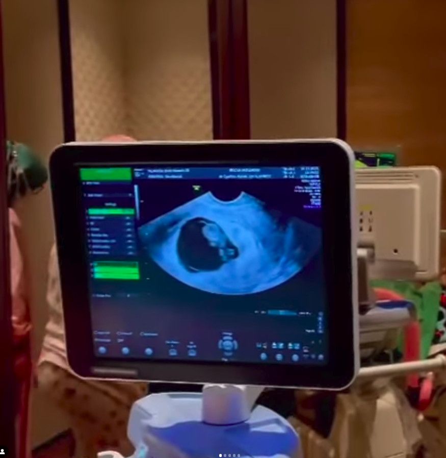 Dea Ananda hamil anak pertama.