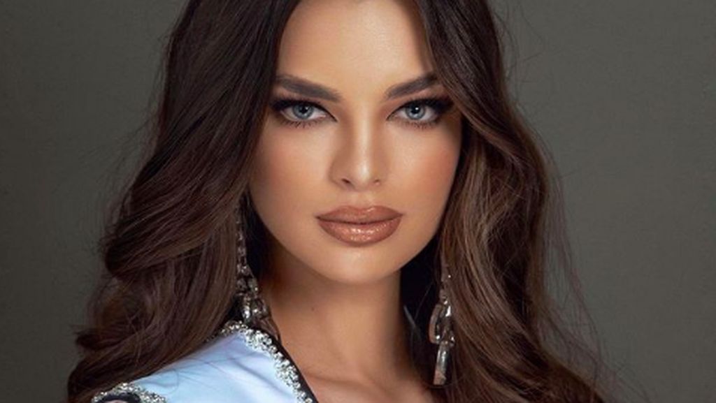 10 Foto Miss Paraguay Jadi Runner Up Miss Universe 2021, Punya Kelainan Kepala