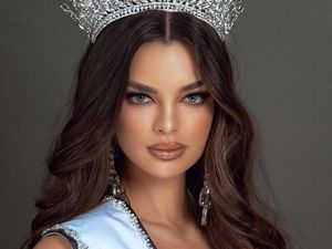 10 Foto Miss Paraguay Jadi Runner Up Miss Universe 2021, Punya Kelainan Kepala 10 Foto Miss Paraguay Jadi Runner Up Miss Universe 2021, Punya Kelainan Kepala