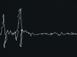 Tak Ingin Kena Jantung Koroner? No Debat, Dokter Sarankan Setop Rokok