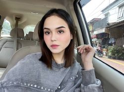 Ahli Fisioterapi Ungkap Kondisi Laura Anna Selama Masa Pengobatan