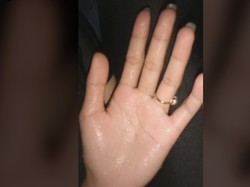 Viral Video Tangan Berkeringat di TikTok, Benarkah Tanda Jantung Lemah?