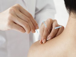 Pakar Fisika Menguak Efektivitas Akupuntur, Semempan Apa Atasi Penyakit?