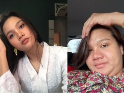 Beda Banget! Perubahan Wajah Wanita Ini saat Hamil Sampai Bikin Tak Dikenali