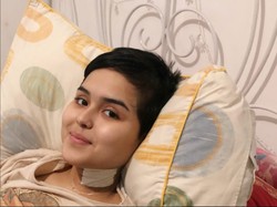 Keluarga Tunjukkan Luka di Kepala Laura Anna yang Disebut Ibu Gaga Cuma Lecet