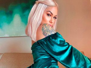 Cerita Model yang Keracunan Implan Payudara dan Hampir Mati