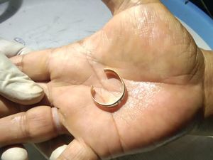 Damkar Jaktim Bantu Warga Copot Cincin yang Setahun Terpasang di Jari