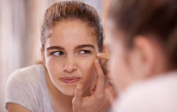 Serum khusus jerawat dapat membuat jerawat jadi lebih cepat kering, dan mencegahnya datang lagi / foto: freeimages.com/tassii