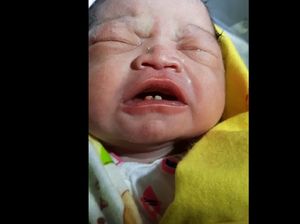 Unik, Bayi di Labura Sumut Lahir Sudah Punya 2 Gigi Unik, Bayi di Labura Sumut Lahir Sudah Punya 2 Gigi