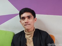 Wajah Remuk Valfero usai Kecelakaan Motor dengan Gaga Muhammad