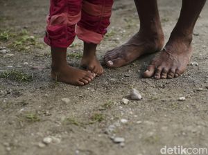 6.495 Balita Alami Stunting, Dinkes Lebak: Ibu-ibu Senang Beri Makanan Instan