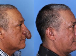 Viral Kisah Pria dengan Hidung Mirip Alat Kelamin, Dapat Keajaiban Saat Natal