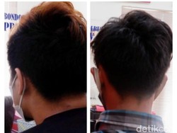 Suami yang Cemburu Buta di Bondowoso Aniaya Teman Istri