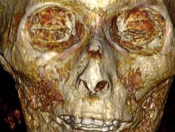 Pertama Kali, Mumi Firaun Usia 3.000 Tahun Diteliti Pakai CT Scan