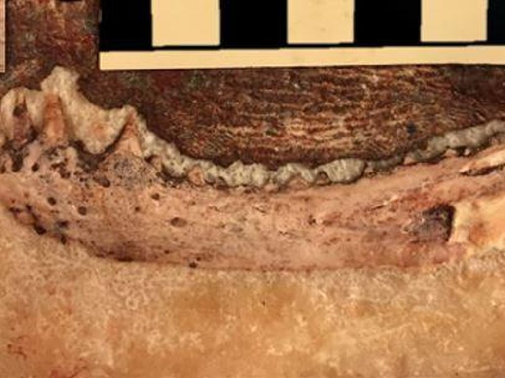 Reptil Punah Ini Ungkap Asal Usul Gigi Manusia Paling Awal