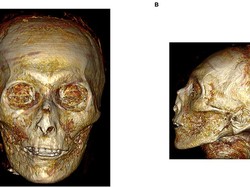 Pertama Kalinya, Ilmuwan Teliti Mumi Firaun 3.000 Tahun Pakai CT Scan