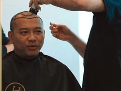 Anang Hermansyah Ikuti Jejak Kevin Aprilio Transplantasi Rambut