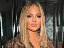 Wajah Chrissy Teigen Berubah Mirip Khloe Kardashian, Dikritik Operasi Plastik