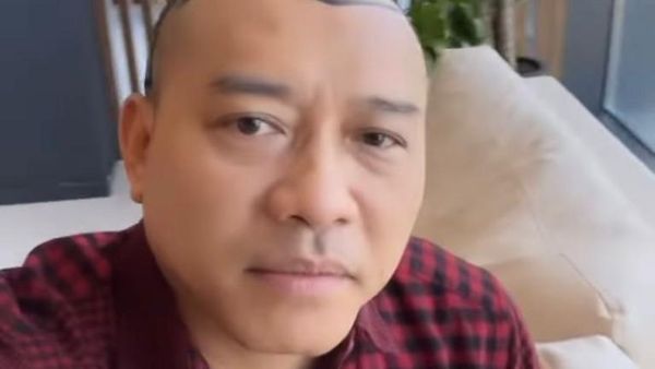 7 Gaya Baru Anang Hermansyah Dengan Rambut Botak, Disebut Mirip Raul Lemos