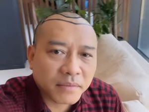 7 Gaya Baru Anang Hermansyah Dengan Rambut Botak, Disebut Mirip Raul Lemos