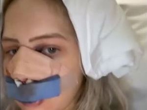 Wanita Ini Oplas Pakai Uang Pinjaman Pendidikan, Dihujat Pembayar Pajak Wanita Ini Oplas Pakai Uang Pinjaman Pendidikan, Dihujat Pembayar Pajak