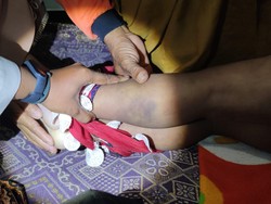 Kejam! Ibu yang Aniaya Anak Hingga Tewas Main Pukul Mulai Kepala Hingga Kaki