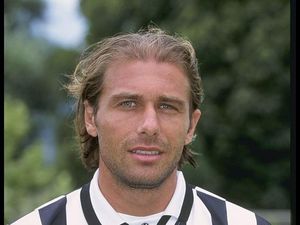 Conte Botak Dini, Kini Gondrong Lagi... Transplantasi adalah Kunci!