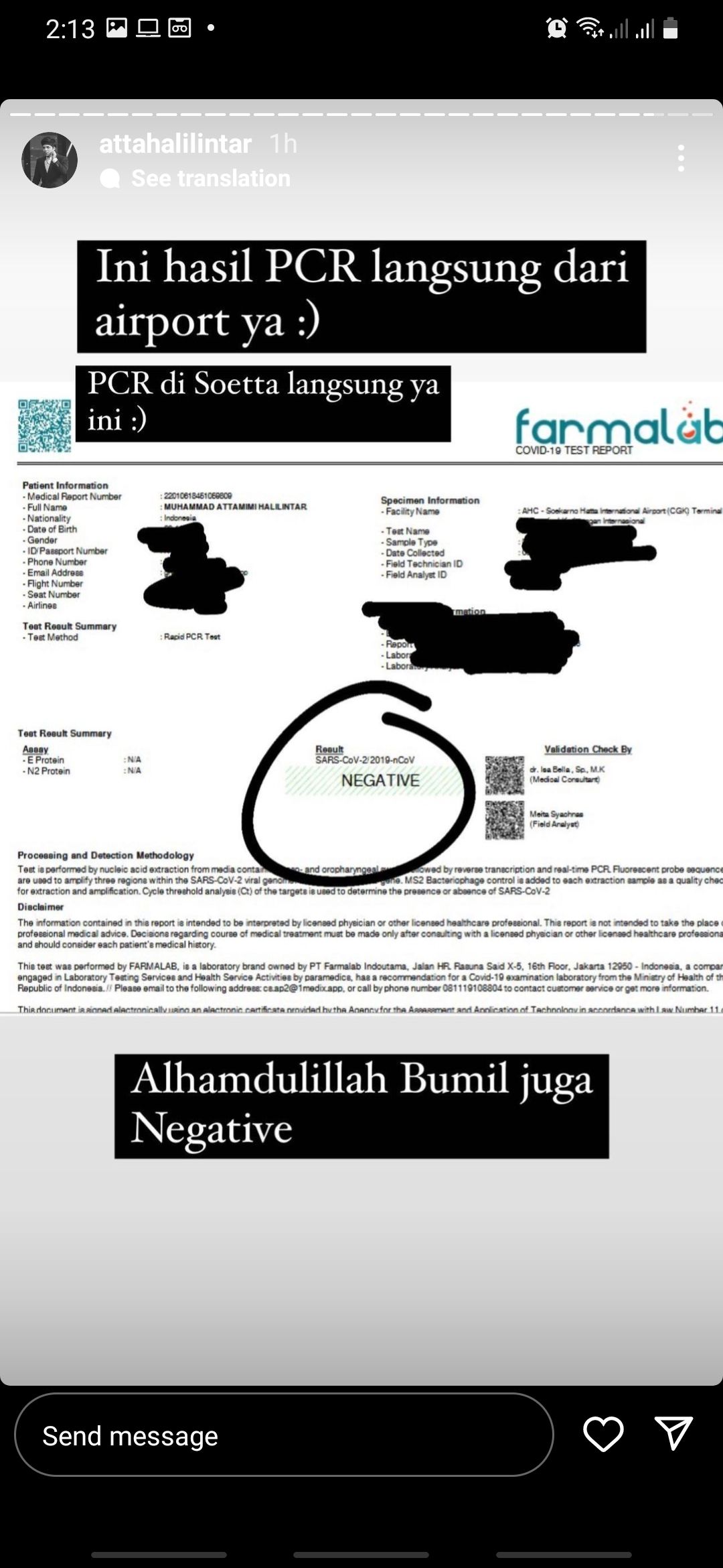 Atta Halilintar dan Aurel Hermansyah negatif COVID-19