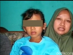 Diduga Punya Kelamin Ganda, Gadis di Brebes Jalani Tes Kromosom
