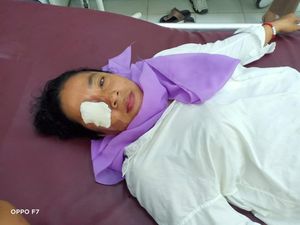Wanita di Asahan Nyaris Buta Disiram Air Keras Suaminya