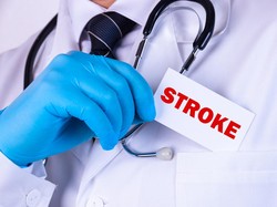 Stroke: Jenis, Gejala, dan Pengobatannya