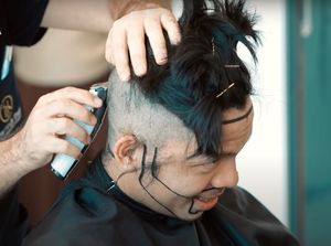 7 Momen Atta Halilintar Transplantasi Rambut, Terpaksa Jadi Botak