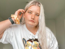 Kisah Wanita yang Terlahir Tak Bisa Senyum, Dulu Di-bully Kini Jadi Selebgram