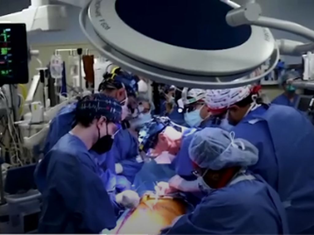 Pertama di Dunia! Tim Dokter AS Transplantasi Jantung Babi ke Manusia