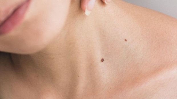 8 Tanda Kulit Sensitif/ unsplash.com/ Angelica Echeverry