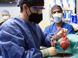 Cangkok Jantung Babi ke Manusia Picu Kontroversi