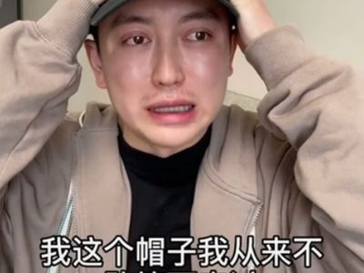 Potret Pria yang Gagal Operasi Plastik, Wajahnya Jadi Lebih Tua 20 Tahun