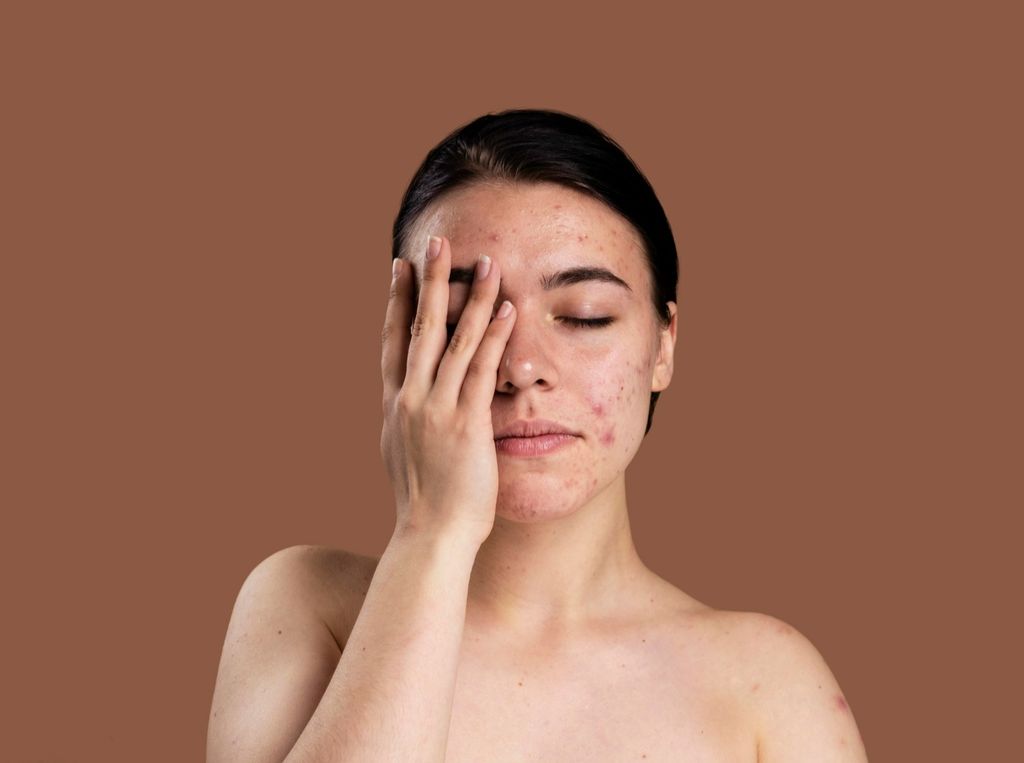 Cara dan produk eksfoliasi yang tepat untuk kulit kering supaya tidak jadi kekeringan dan iritasi/Foto: Freepik.com/Freepik