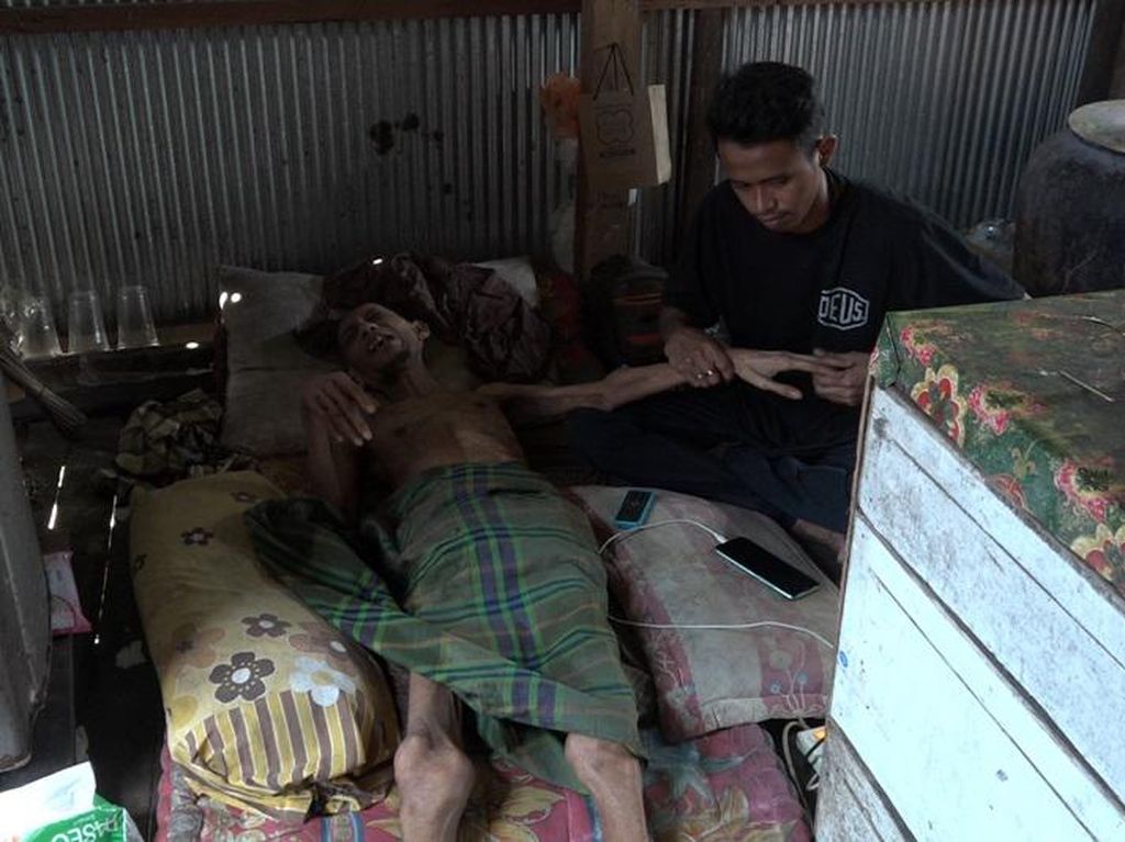 Tak Punya Biaya Berobat, Pria di Sulbar 2 Tahun Terbaring karena Sakit Gula
