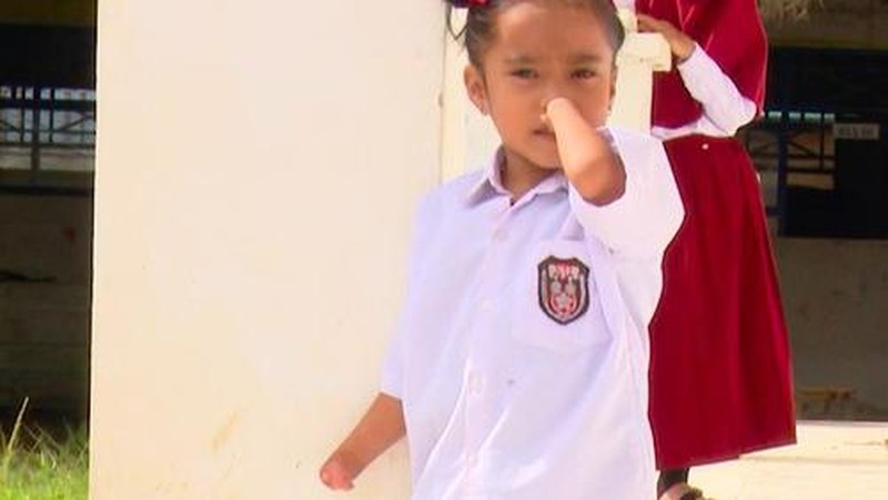 Tegarnya Bocah Tanpa Telapak Tangan dan Kaki di Polman, Kamu Bisa Bantu Dia