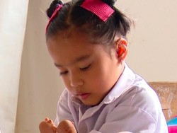 Sosok Fitriani, Gadis Tanpa Telapak Tangan-Kaki yang Tak Pernah Menyerah