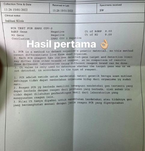 2 Kali Terpapar, Ashanty Umumkan Sembuh dari COVID-19