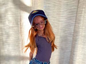 10 Foto Adalia Rose, Youtuber yang Meninggal karena Sindrom Benjamin Button 10 Foto Adalia Rose, Youtuber yang Meninggal karena Sindrom Benjamin Button