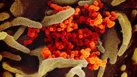 Wujud Virus Corona Dilihat dari Dekat, Mengerikan!