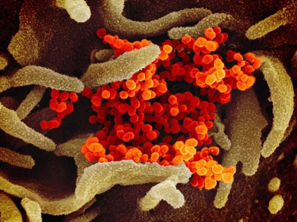 Wujud Virus Corona Dilihat dari Dekat, Mengerikan!