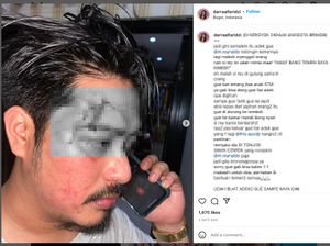 Kronologi Artis FTV Darra Permata Al Faridzi Ngaku Dikeroyok