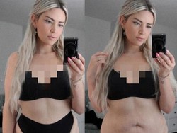 Viral Influencer Pamer Perut Bergelambir & Penuh Selulit, Ungkap Pesan Positif