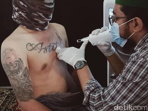 Puluhan Orang Ikut Kegiatan Hapus Tato di Klaten, Begini Tekniknya