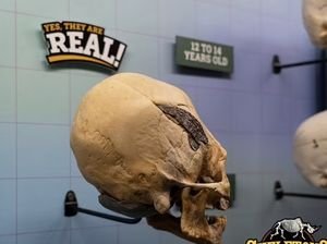 Terungkap, Fakta di Balik Tengkorak Manusia Berwujud Aneh