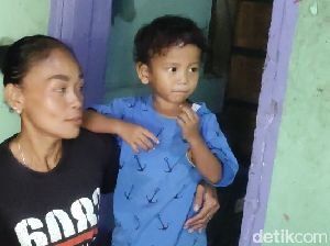 Heboh Bocah di Cianjur Disunat Gaib, Ini Penjelasan Dinkes Heboh Bocah di Cianjur Disunat Gaib, Ini Penjelasan Dinkes